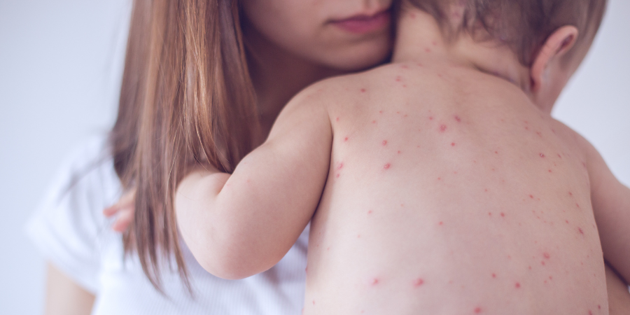 Measles Disinfection